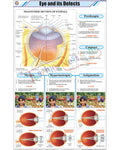 Eye and its Defects Chart - Laminated, With Rollers