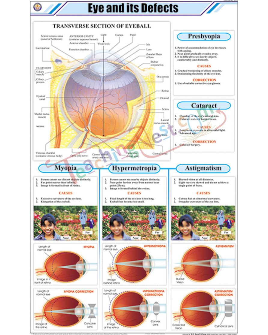 Eye and its Defects Chart - Laminated, With Rollers