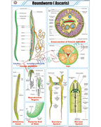 Roundworm (Ascaris) Chart - Laminated, With Rollers