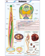 Hookworm Chart - Laminated, With Rollers