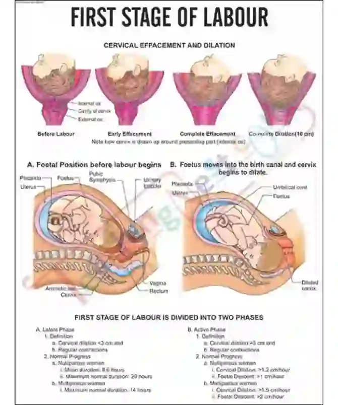 First Stage of labour Chart, 51 x 66 cm