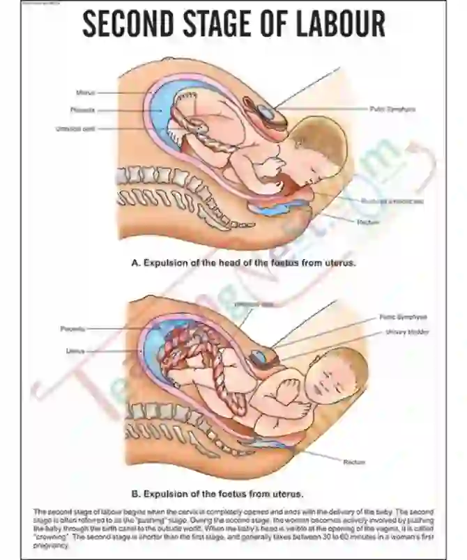 Second Stage of labour Chart, 51 x 66 cm