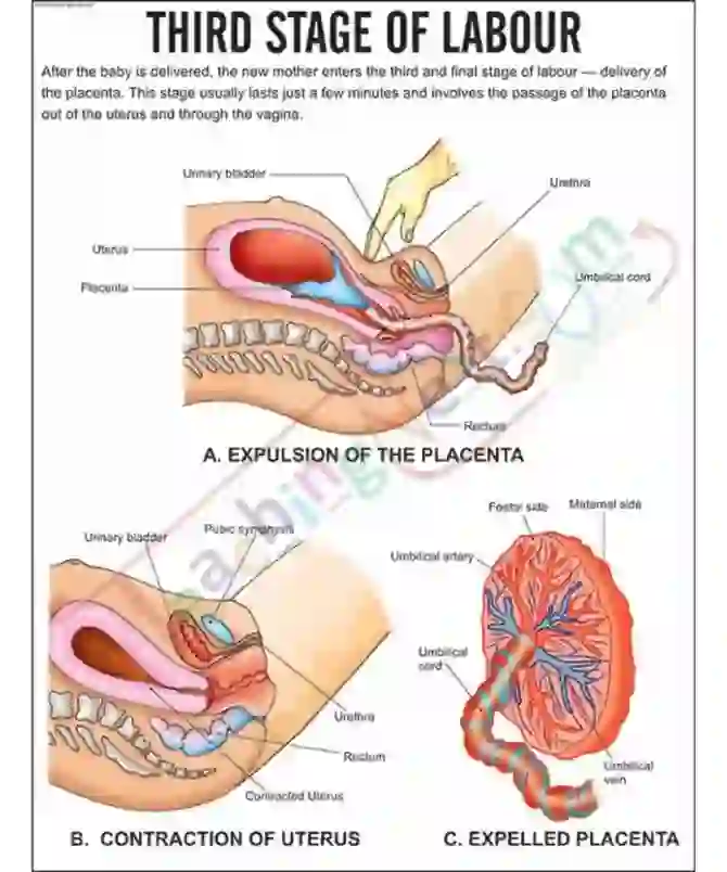 Third Stage of labour Chart, 51 x 66 cm