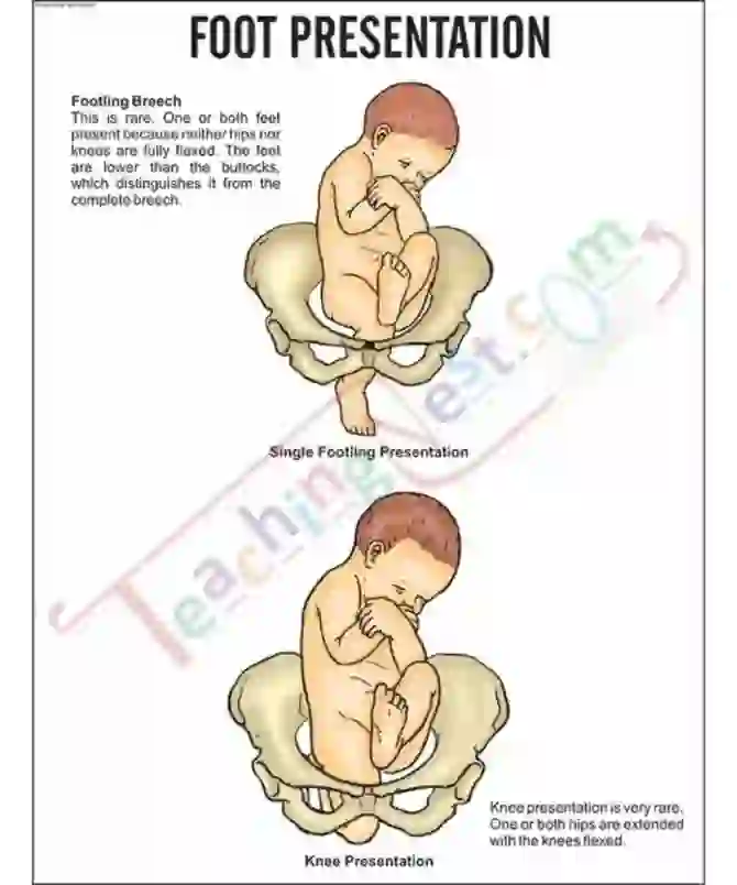 Foot Presentation Chart, 51 x 66 cm