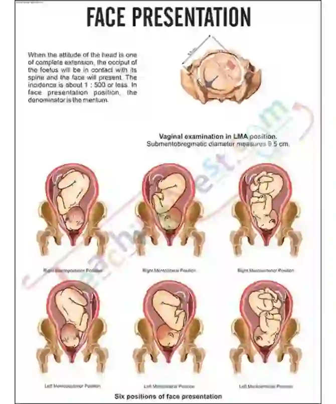 Face Presentation Chart, 51 x 66 cm