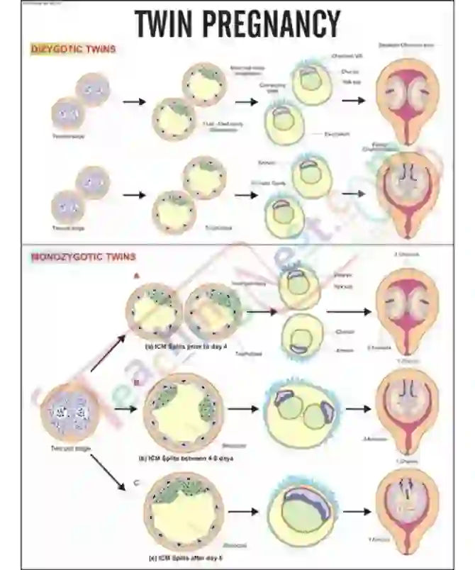 Twin Pregnancy Chart, 51 x 66 cm