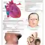 Congenital Malformation of New Born Chart, 51 x 66 cm