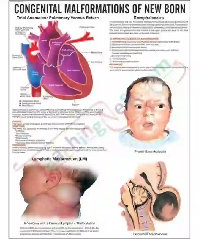 Congenital Malformation of New Born Chart, 51 x 66 cm